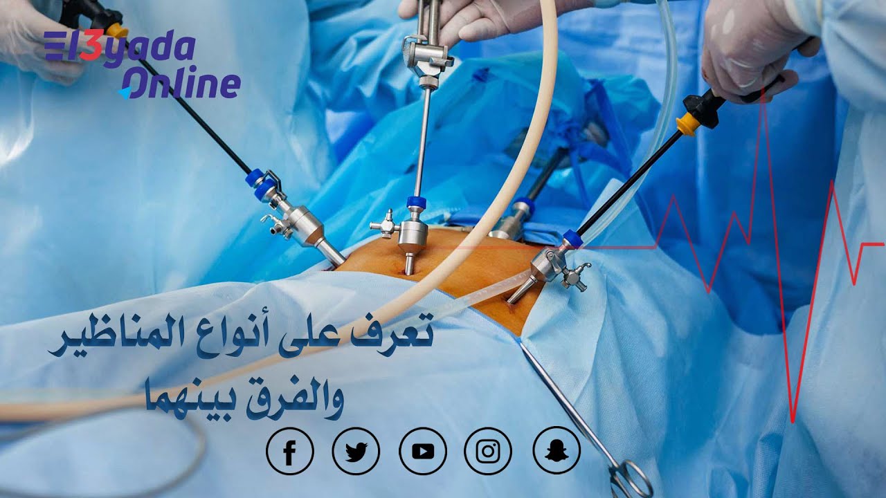 العيادة أونلاين || المناظير الطبية.. أنواعها والفرق بينها