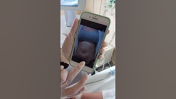 Bác sĩ Chiêm Quốc Thái tư vấn giảm cân an Toàn và Hiệu Quả Cao tại BV Việt Mỹ #giambeobung #giảmcân