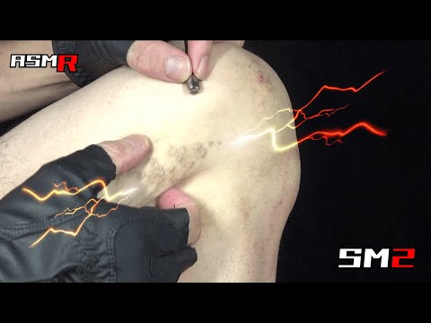 【眠くなるアトピー性皮膚炎ASMR】超痒い脚の内側の「ぶつぶつ」を爪で掻く音/癒し/リラックス効果/睡眠導入/マッサージ
