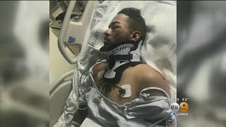 Bicyclist Hospitalized After Hit And Run