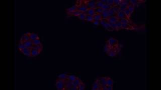 Lncap In Geltrex.avi