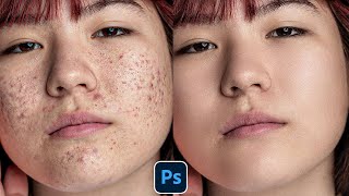 Face Retouching - Best Photoshop Tutorial | Skin Retouching 2023 | Photoshop Tutorial in Hindi