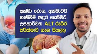 අක්මා රෝග, අක්මාවට හානිවිම් අදුරගැනිමට උපකාරිවන ALT රුධිර පරික්ෂාව | ALT Test Sinhala | Akma Roga