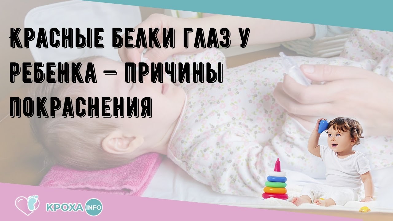 Красные белки глаз у ребенка — причины покраснения - YouTube