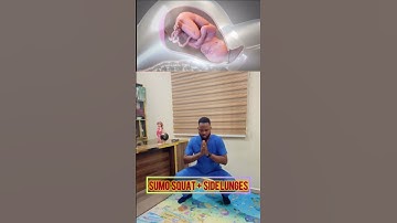 Simple exercise to speed up your labour
