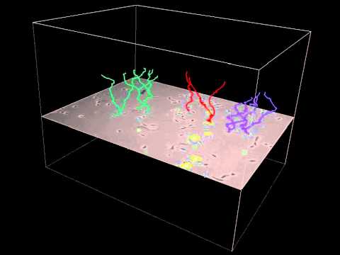 Mitosis Detection with Tree