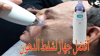 جهاز شفط الدهون من البشره والانف وجلسه تنظيف البشره