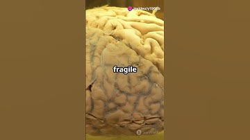 How Does Consciousness Emerge – Cracking the Code of the Mind #brainboost #facts #science #shorts