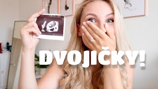 Čakáme Dvojičky! | 8.-12.týždeň | Tehotenský Update | PauliBeauty