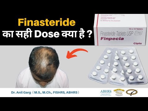 Finasteride का सही Dose क्या है?  Baldness, Hair Loss - Side Effects &