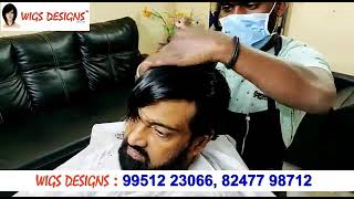 Hair Fixing in Bangalore | 8247798712 | 9951223066