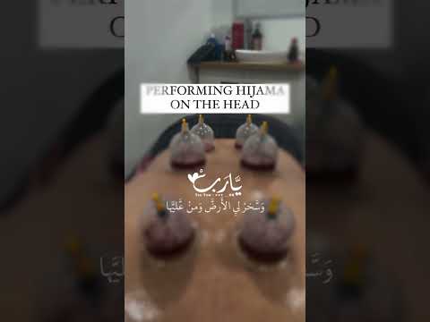 خير ما تداويتم به الحجامة 