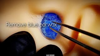 ASMR Remove the blue earwax that sparks your curiosity★ Tingle👍 No talking