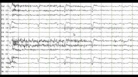 Mu Rhythm