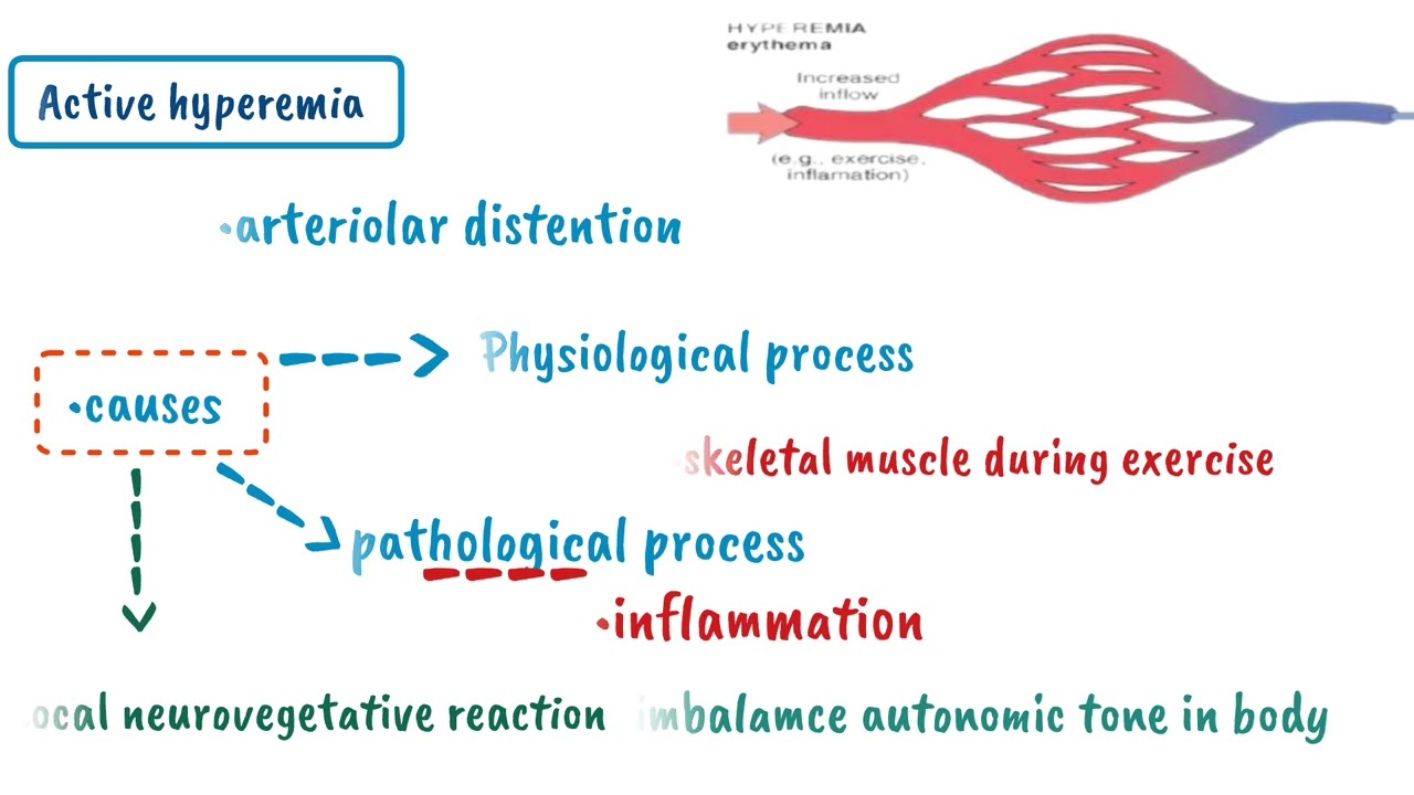 Hyperemia | Active Hyperemia vs Passive Hyperemia| General Pathology 