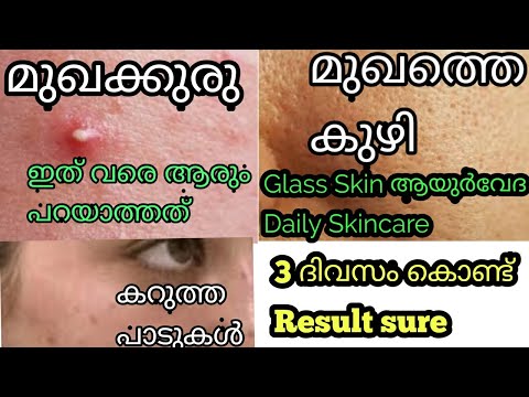 ഇത് വരെ ആരും പറയാത്ത ആയുർവേദ skincare| മുഖക്കുരു മുഖത്തെ കുഴികൾ കറുത്തപാടുകൾ 3ദിവസം കൊണ്ട് മാറും