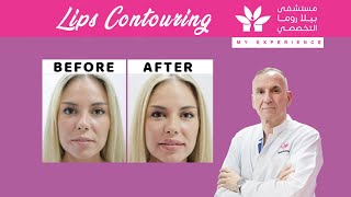 Best Lip Contouring in Bellaroma Hospital | By Doctor Zoran Lekic