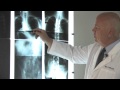 Scoliosis Treatment Options for Children and Adults | El Camino Hospital