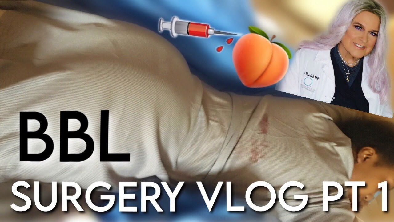 bbl surgery journey