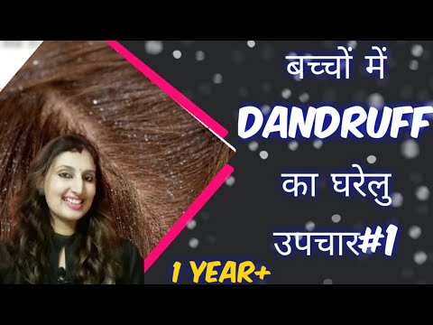 बच्चों-में-डैंड्रफ-का-घरेलु-उपचार#1||-home-remedy-for-dandruff-and-hair-growth-in-babies