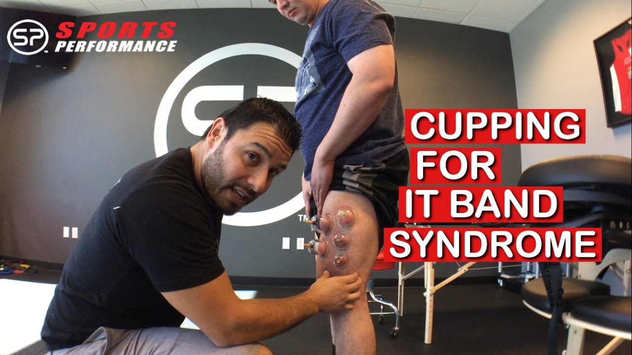 It Band Syndrome Cupping Therapy Knee Pain Treatment Sports