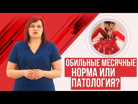 Обильные месячные. Норма или патология? Маточные кровотечения.