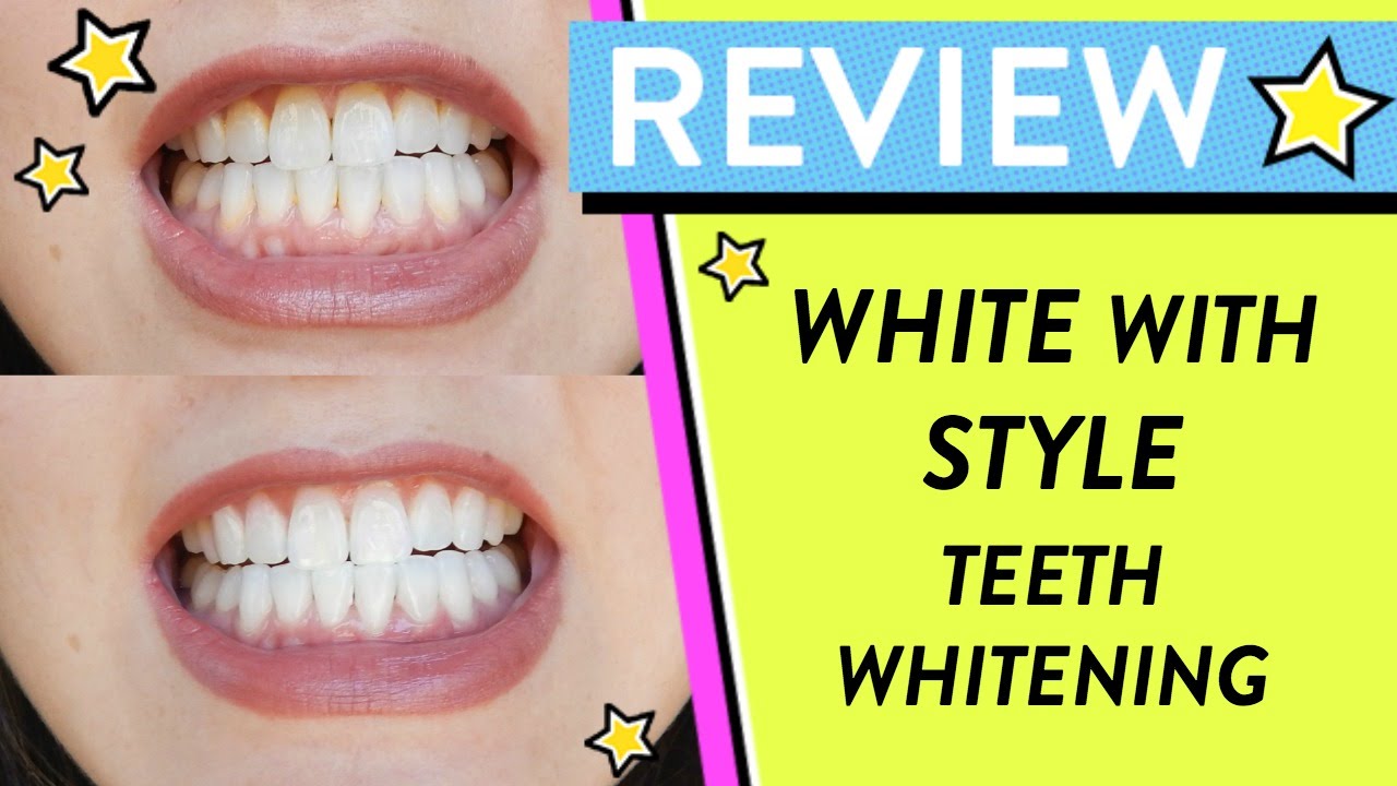 Style White Teeth Whitening Kit Reviews - TeethWalls