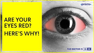 Redness of the Eyes: Causes & Symptoms | Iridocyclitis, Glaucoma & Conjunctivitis Symptoms || Practo