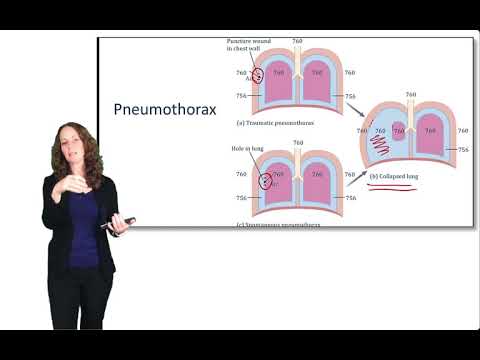 Respiratory System: Ventilation - YouTube