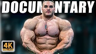 NICK WALKER (Full Documentary) ❌ The KID who become a MUTANT hamstring injury mr olympia 2023