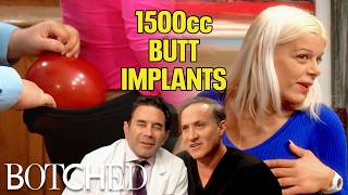 Martina Wants 1500cc Butt Implants to Match Her 3700cc Breast Implants Rejected By Botched E