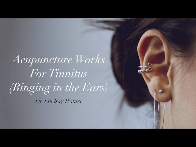Acupuncture for Hearing Loss & Tinnitus: Does it Really Work?