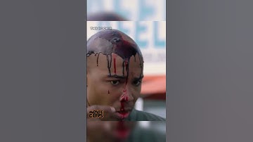He has been shot in the head | The rookie #therookie #series #thirtythree #shorts