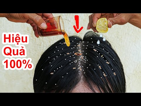 Video Chỉ Cần 3 Ngày NẤM TÓC , GẦU , CHẤY Sẽ Hết Sạch Với... - youtube
