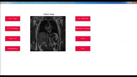 Projects on Image Processing with Source Code | Thesis on Image Processing with Source Code