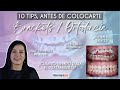 10 Tips antes de colocarte  #Brackets / #Ortodoncia ✅ - Odontología Láser.