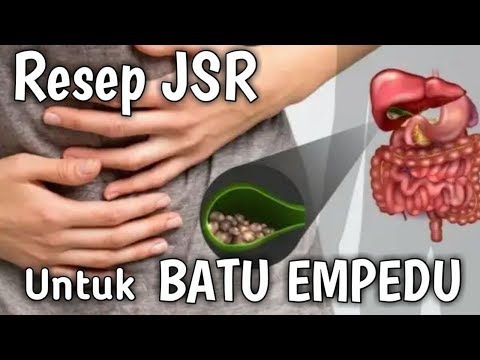 Cara Mengobati BATU EMPEDU || Resep Dr Zaidul Akbar ||