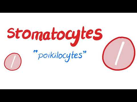 Videó: Poikilocytosis: Tünetek, Kezelés, Kilátások és Egyebek