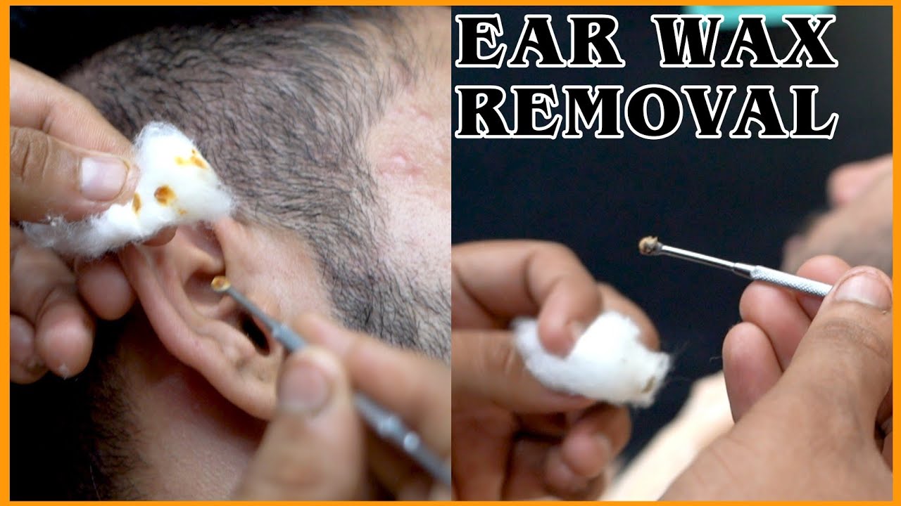 ASMR} Dirtiest Deep Ear Cleaning Wax Removal and Head Massage by  VIKRAM💈#asmr 