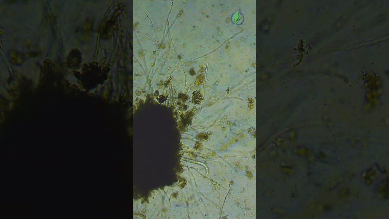 A cluster of fungi is growing,a nematode feeds nearby,a flagellate moves through space and bacteria