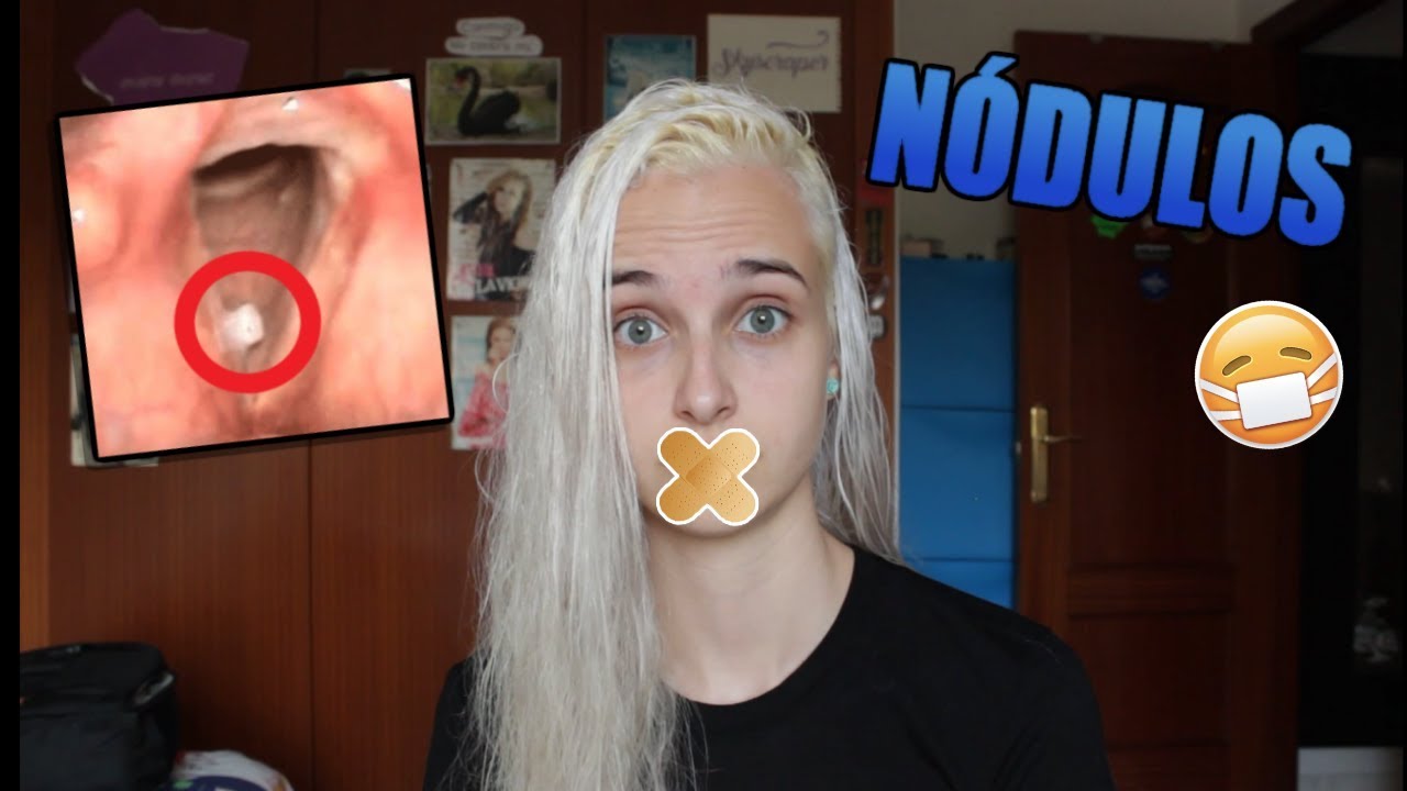 Tratamiento natural para los nodulos en las cuerdas vocales