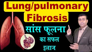 Lung Fibrosis Pulmonary Fibrosis I फाइब्रोसिस और साँस फूलना सफल इलाज screenshot 5