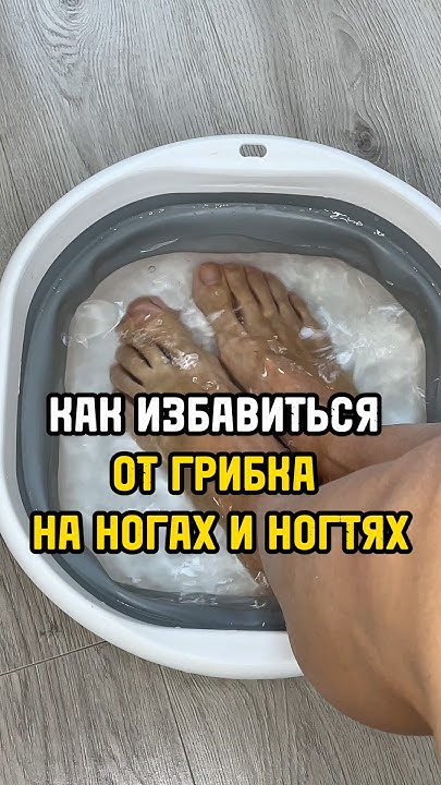 Грибок ногтей на ногах лечение в домашних условиях. - YouTube