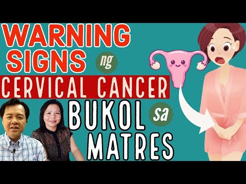 Video: Paano Mapupuksa ang Uterine Fibroid Pain (na may Mga Larawan)