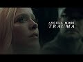 Angela Moss | Trauma