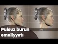 Burnuna əl gəzdirmək istəyənlərin nəzərinə! - Baku TV