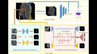 Celebrity [P117] Prior Guided 3D Medical Image Landmark Localization Profile