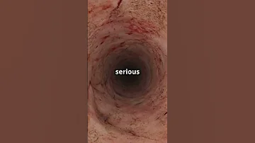 Invideo Ai 1080 Https Youtu Be Ab9OZsDECZw Si OYaG GAEZQgJIJ 