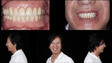 Case of the Week: Making Life Easy With Digital Dentistry