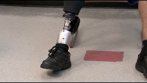 Volti Subito Videos:   Active Life Prosthetics in Albuquerque, NM (Video Advertisement)